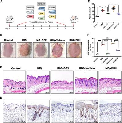 Punicalagin Alleviates Psoriasis by Inhibiting NF-κB-Mediated IL-1β Transcription and Caspase-1-Regulated IL-1β Secretion